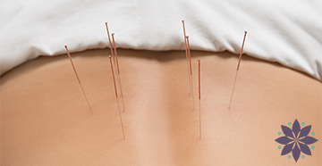 Annapolis Acupuncture Services Featured HP