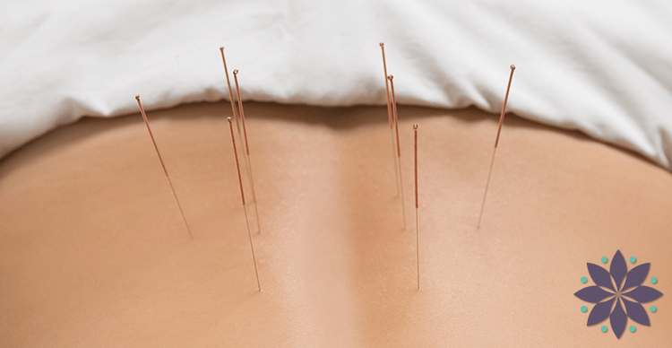 Annapolis Acupuncture Services