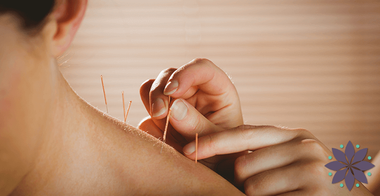 annapolis acupuncture appointment request