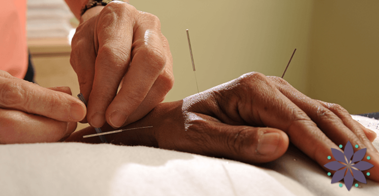 Why Acupuncture?