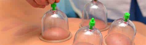 Cupping Therapy Guide - Jess Faulkner